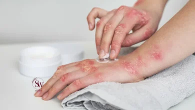 Dry Skin Between Fingers