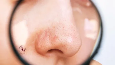 Get Rid of Blackheads on Nose